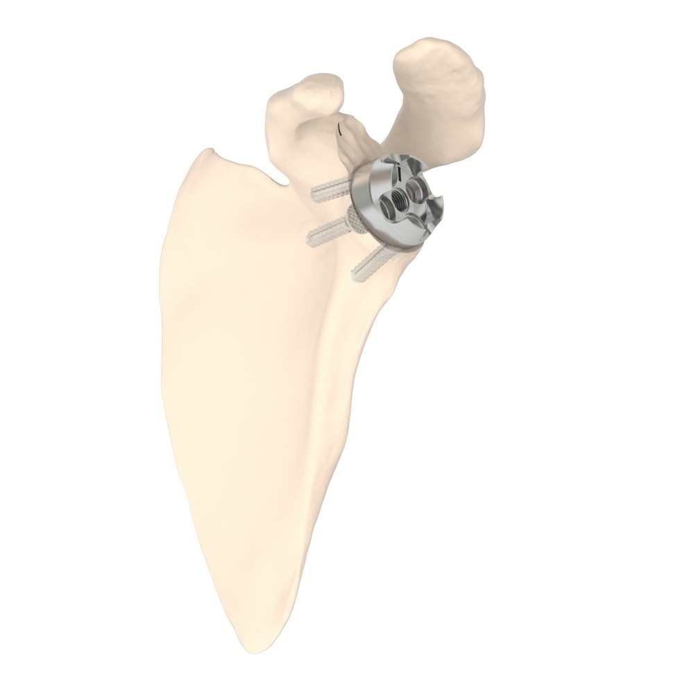 Image for 